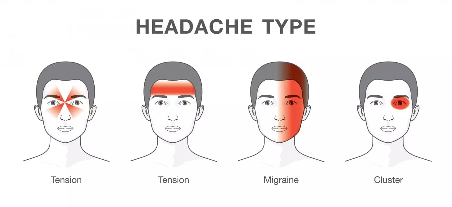 Image result for headache types