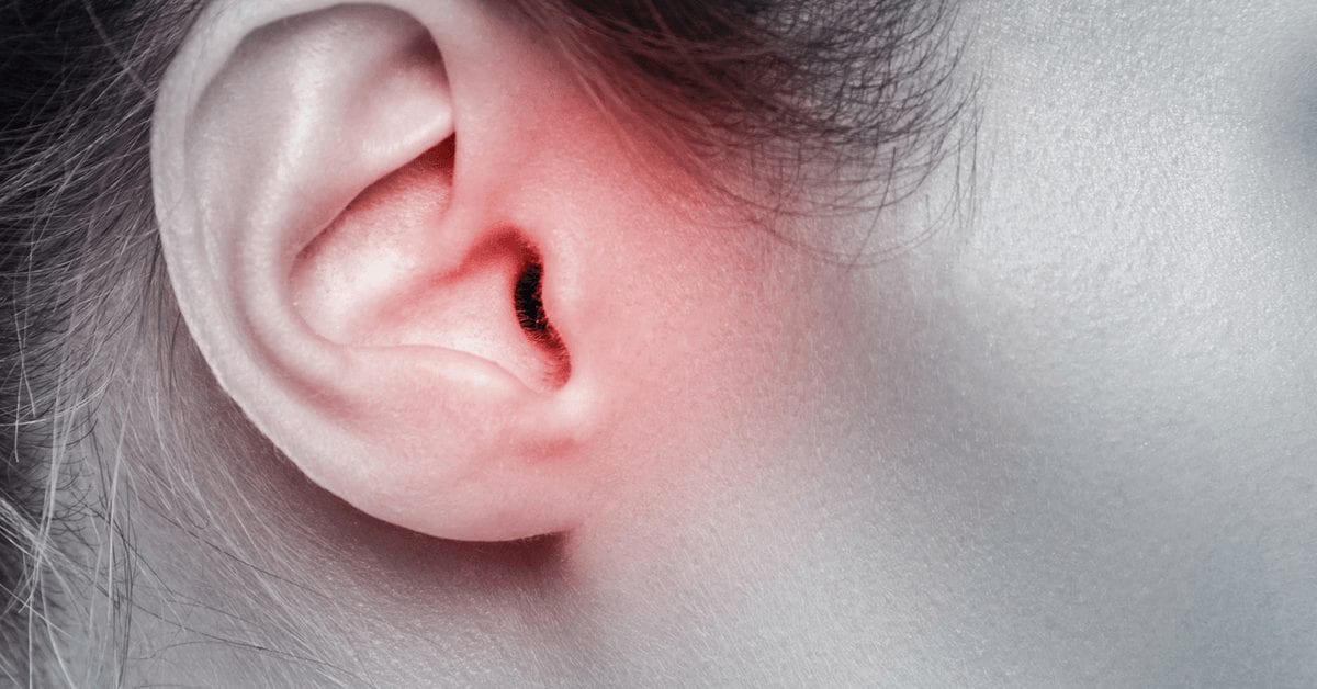 Earring For Migraine Relief 2024 | mainlinetaxi.com