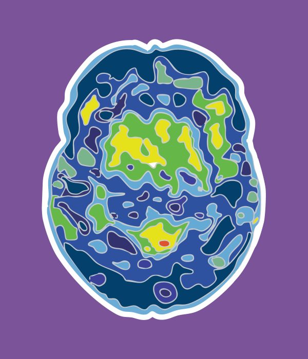 brain